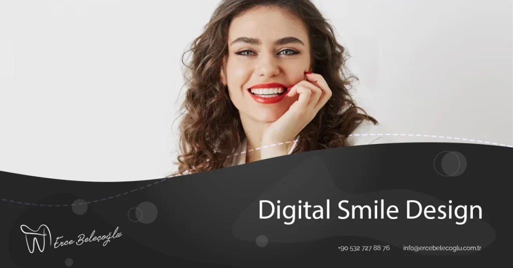 Digital Smile Design