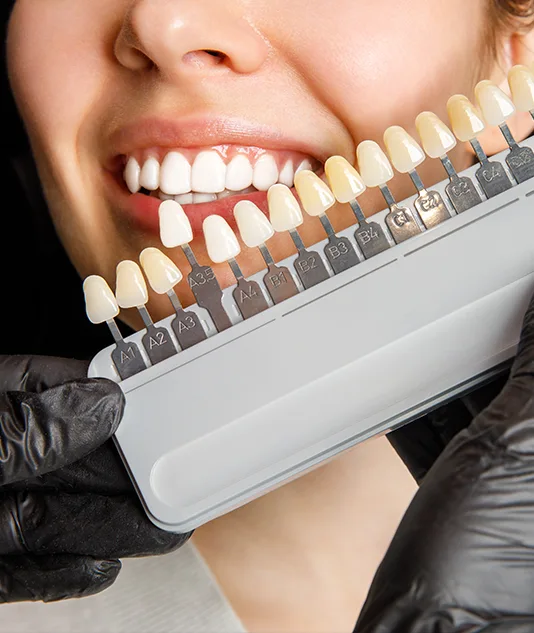 Smile Design Turkey