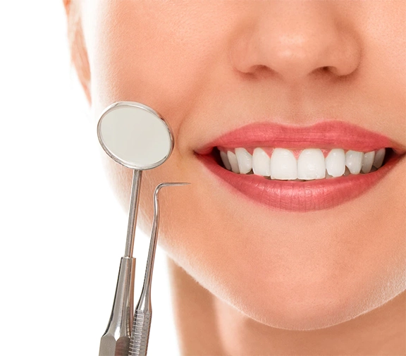 smile design