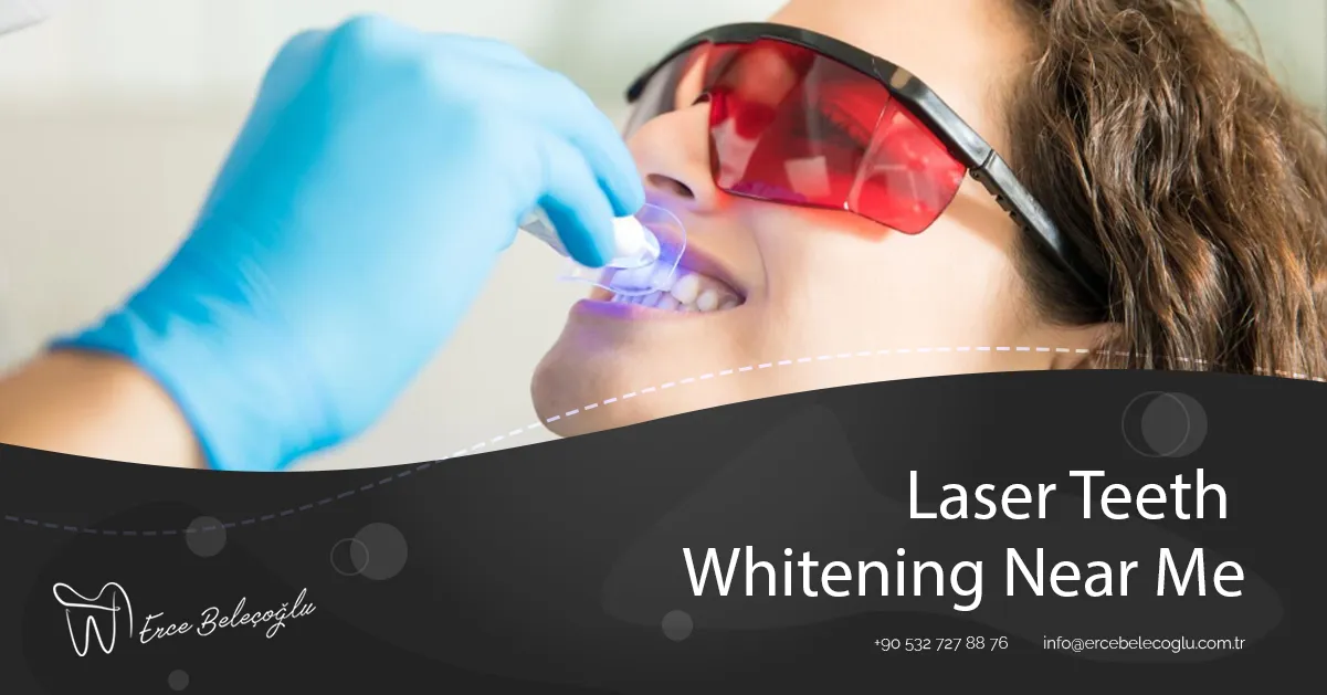 Laser Teeth Whitening Near Me