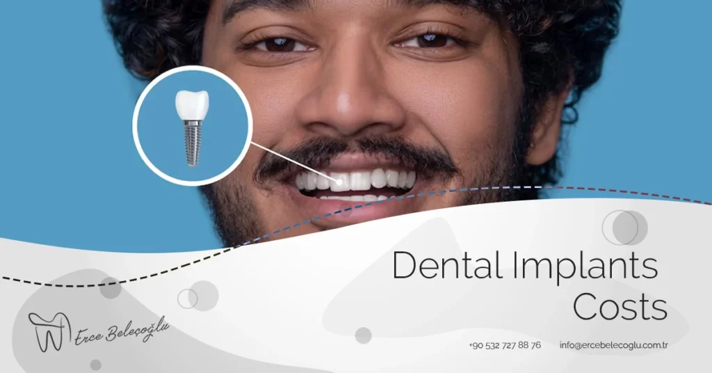 Dental Implants Costs