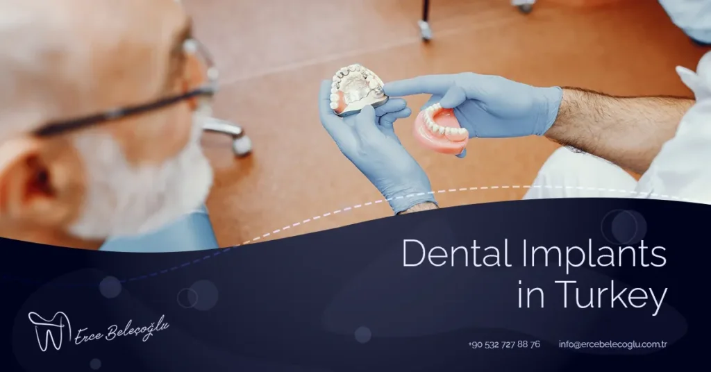 Dental Implants in Turkey