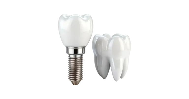 types of dental implants 002